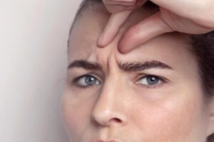 do repeated expressions cause frown lines