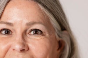can crow's feet be prevented