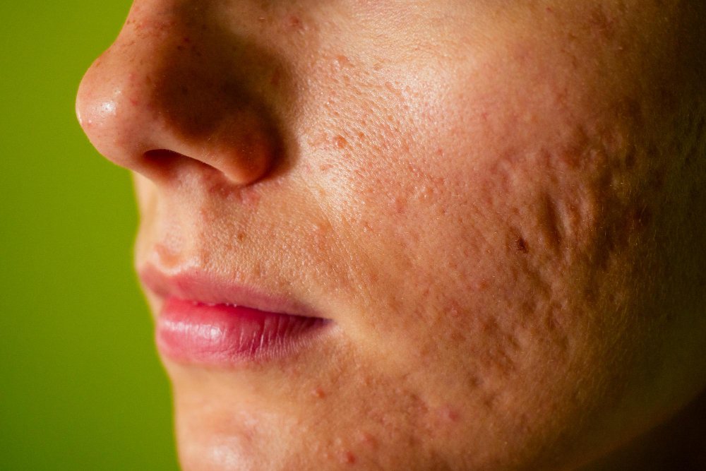 is it normal to worry about scars fading on their own