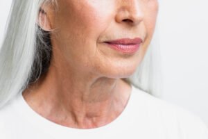 does lack of collagen cause a droopy face