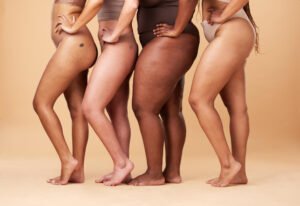do hormones cause lipoedema