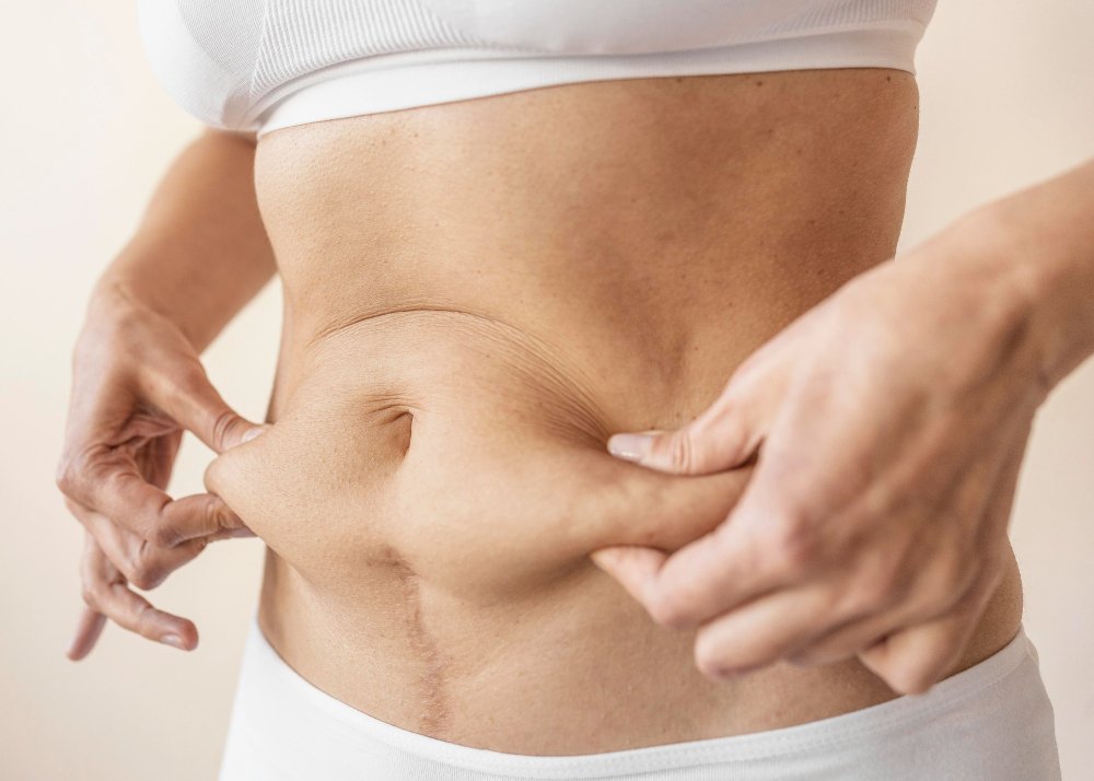 can loose skin be prevented