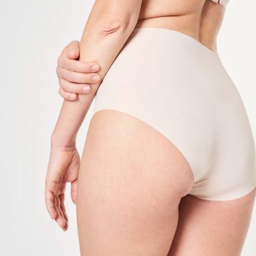 flat buttocks