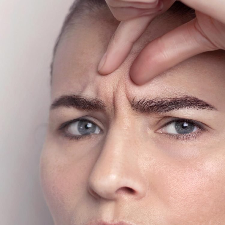 do repeated expressions cause frown lines