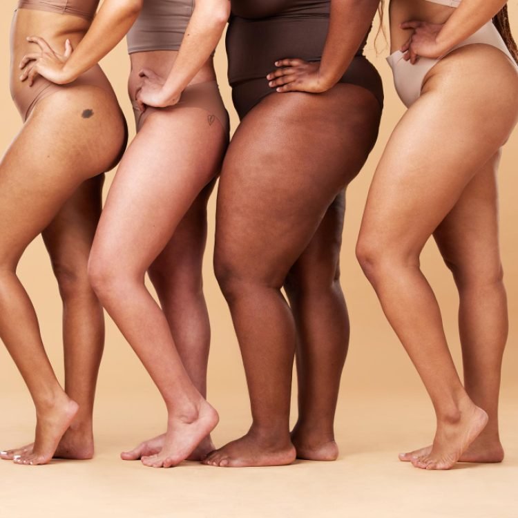 do hormones cause lipoedema