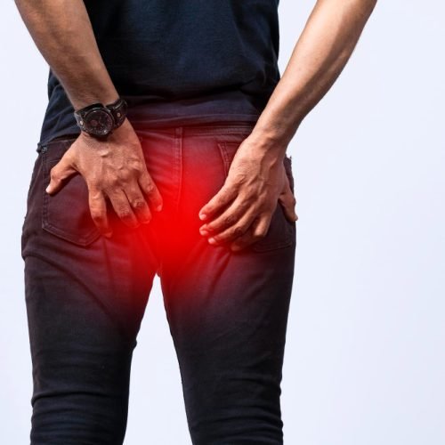 anal warts