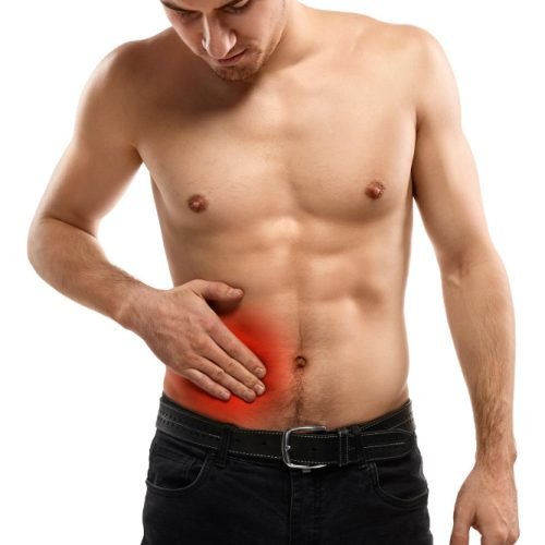 hernia