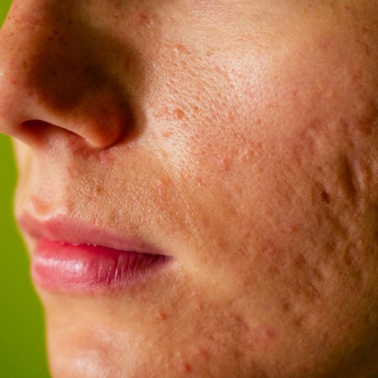 is it normal to worry about scars fading on their own
