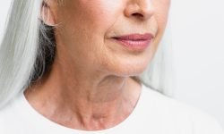 does lack of collagen cause a droopy face