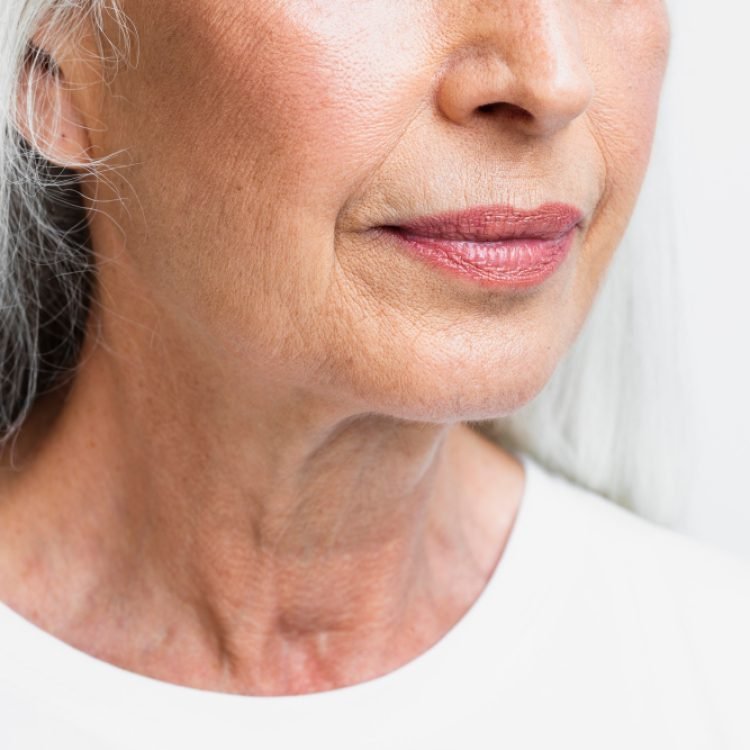 does lack of collagen cause a droopy face