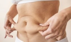 can loose skin be prevented