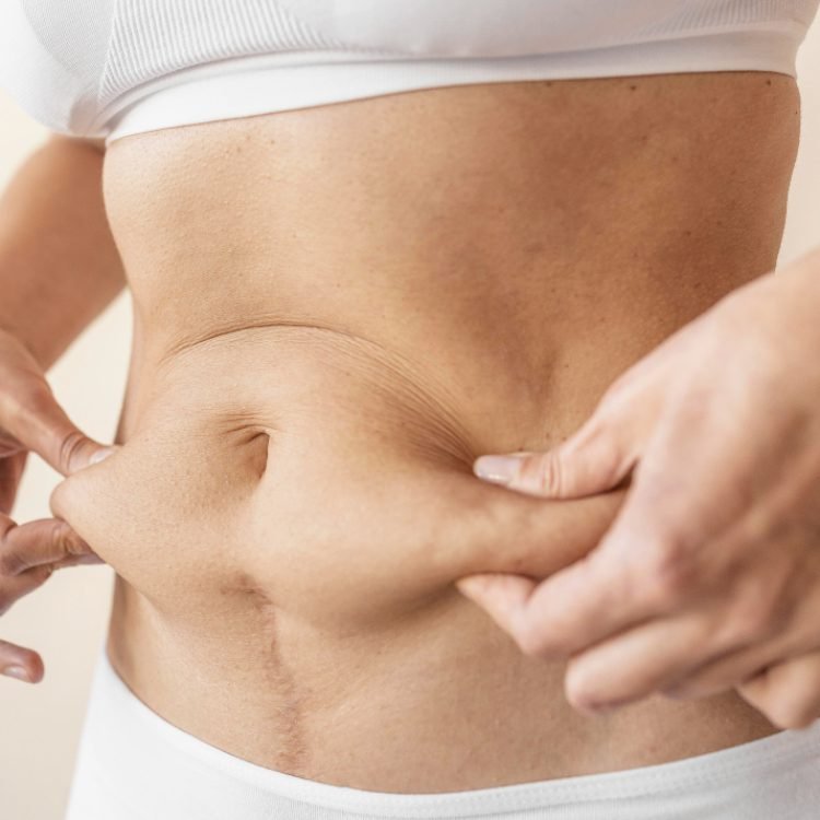 can loose skin be prevented