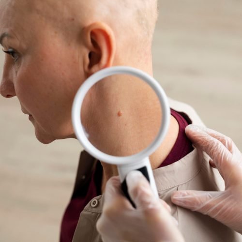 cysts and lumps