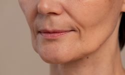 can a droopy face be prevented