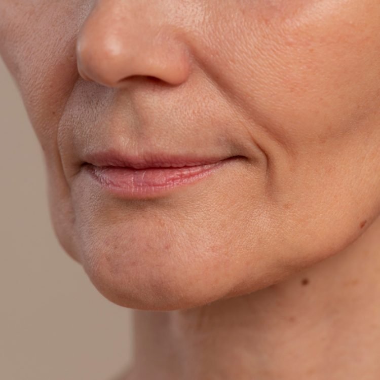 can a droopy face be prevented