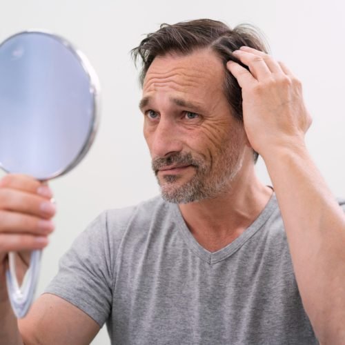 hair loss