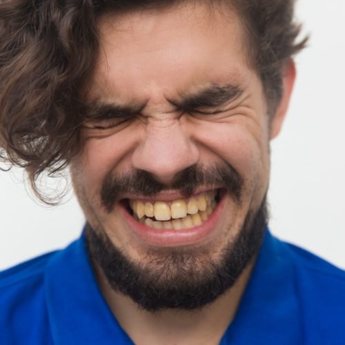 discoloured teeth