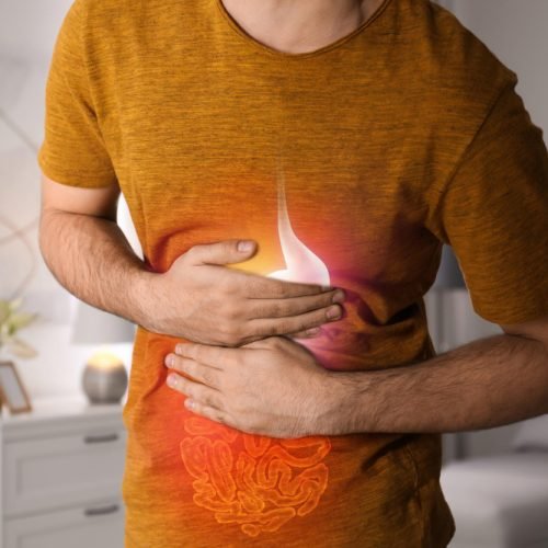 acid reflux