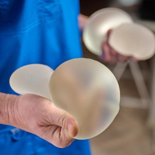 existing breast implants